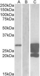 Antibody anti-GM2A A82718-100 100 µg