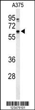 Anti-DCT Rabbit Polyclonal Antibody [clone: 407CT20.1.2]