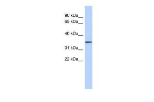 Anti-FBXO31 Rabbit Polyclonal Antibody