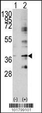 Anti-LIVIN Rabbit Polyclonal Antibody (AP (Alkaline Phosphatase))