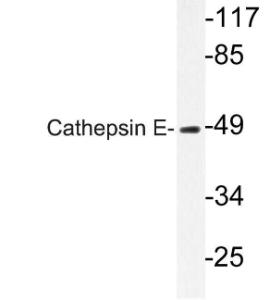 Anti-Cathepsin E Rabbit Polyclonal Antibody