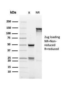 SDS-PAGE analysis of Anti-MUC1 Antibody [rMUC1/4418] under non-reduced and reduced conditions; showing intact IgG and intact heavy and light chains, respectively. SDS-PAGE analysis confirms the integrity and purity of the antibody