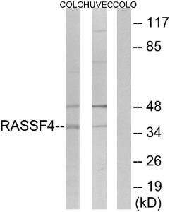 Western blot analysis of lysates from COLO and HUVEC cells using Anti-RASSF4 Antibody. The right hand lane represents a negative control, where the antibody is blocked by the immunising peptide