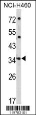 Anti-CER1 Rabbit Polyclonal Antibody