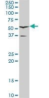 Anti-HNF1B Mouse Monoclonal Antibody [clone: 4E9]