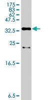 Anti-DBF4 Mouse Polyclonal Antibody