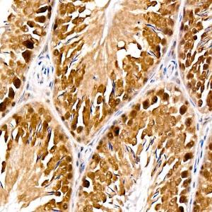 Immunohistochemistry analysis of paraffin-embedded rat testis using Anti-PARG Antibody [ARC59258] (A309888) at a dilution of 1:100 (40X lens). Perform high pressure antigen retrieval with 10 mM citrate buffer pH 6.0 before commencing with IHC staining protocol