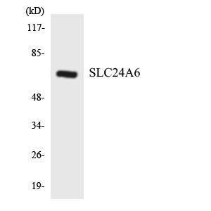 Anti-SLC24A6 antibody