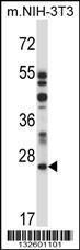 Anti-LAPTM4A Rabbit Polyclonal Antibody (HRP (Horseradish Peroxidase))