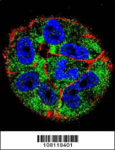 Anti-TP53 Rabbit Polyclonal Antibody (AP (Alkaline Phosphatase))