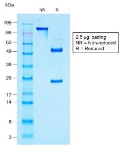 SDS-PAGE analysis of Anti-MUC1 Antibody [rMUC1/960] under non-reduced and reduced conditions; showing intact IgG and intact heavy and light chains, respectively. SDS-PAGE analysis confirms the integrity and purity of the antibody.