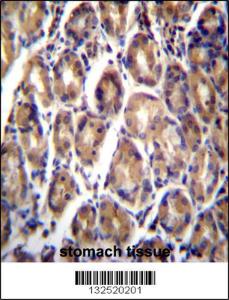 Anti-RARRES1 Rabbit Polyclonal Antibody (Biotin)