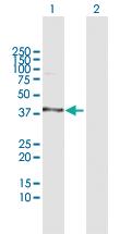 Anti-DHDH Rabbit Polyclonal Antibody