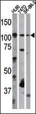 Anti-RB1 Rabbit Polyclonal Antibody (PE (Phycoerythrin))