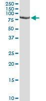 Anti-PCSK1 Mouse Monoclonal Antibody [clone: 3D2]