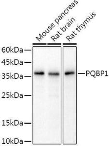 Western blot analysis of extracts of various cell lines, using Anti-PQBP1 Antibody [ARC2697] (A309889) at 1:1,000 dilution