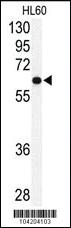 Anti-USP2 Rabbit Polyclonal Antibody