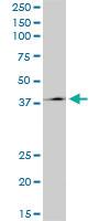 Anti-HNF1B Mouse Monoclonal Antibody [clone: 4E9]