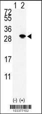 Anti-SUMO2, SUMO3 Rabbit Polyclonal Antibody