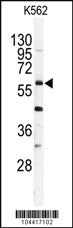 Anti-USP2 Rabbit Polyclonal Antibody