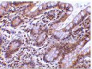 Anti-Livin Rabbit Polyclonal Antibody