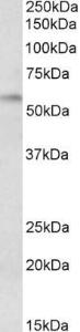 Anti-DGAT1 Antibody (A84286) (0.3 µg/ml) staining of Rat Duodenum lysate (35 µg protein in RIPA buffer). Primary incubation was 1 hour. Detected by chemiluminescence