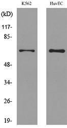 Western blot analysis of lysate from K56 HUVEC cells using Anti-SLC22A6 Antibody