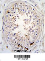 Anti-USP2 Rabbit Polyclonal Antibody