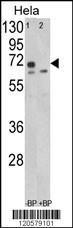 Anti-LMOD1 Rabbit Polyclonal Antibody