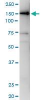 Anti-SMC3 Rabbit Polyclonal Antibody