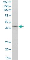 Anti-HNF1B Mouse Monoclonal Antibody [clone: 4E9]