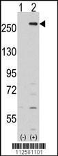 Anti-LMTK2 Rabbit Polyclonal Antibody