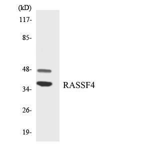 Anti-RASSF4 antibody