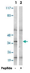 Anti-ND1 Rabbit Polyclonal Antibody