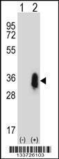 Anti-CD27 Rabbit Polyclonal Antibody (APC (Allophycocyanin))