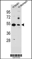 Anti-SLC16A11 Rabbit Polyclonal Antibody (AP (Alkaline Phosphatase))