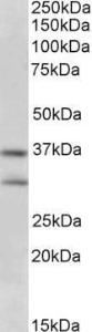 Anti-FGF23 antibody