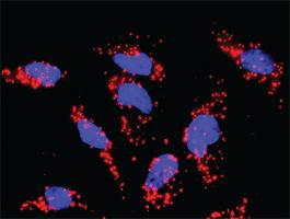 Anti-FGFR1 + PIK3R1 Antibody Pair