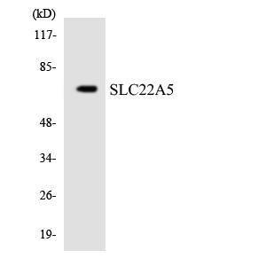 Western blot analysis of the lysates from HeLa cells using Anti-SLC22A5 Antibody