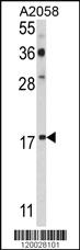 Anti-PDRG Rabbit Polyclonal Antibody