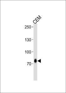 Anti-ZNF219 Rabbit Polyclonal Antibody