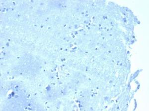 Negative Control: Immunohistochemical analysis of formalin-fixed, paraffin-embedded human brain stained with Anti-delta 1 Catenin Antibody [CTNND1/4383R] at 2 µg/ml in PBS for 30  minutes at room temperature