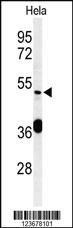 Anti-DDX49 Rabbit Polyclonal Antibody