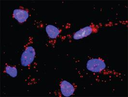 Anti-GSK3B + CDH1 Antibody Pair