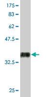 Anti-RUNX2 Mouse Monoclonal Antibody [clone: 2B9]