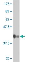 Anti-NOCT Mouse Monoclonal Antibody [clone: 3E8]