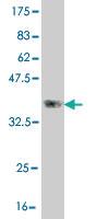 Anti-CLCA2 Mouse Monoclonal Antibody [clone: 1B9]