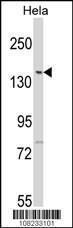 Anti-LMTK2 Rabbit Polyclonal Antibody (HRP (Horseradish Peroxidase))