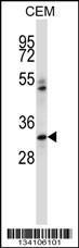 Anti-IBSP Rabbit Polyclonal Antibody (Biotin)