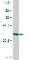 Anti-PRKCH Mouse Polyclonal Antibody